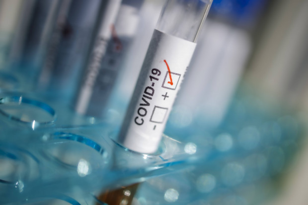 Israel: Cyber-Security contra Corona