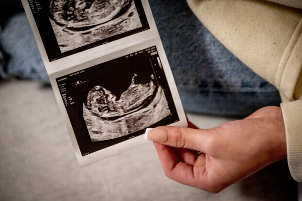 Blick in die Black Box: Was passiert eigentlich bei einer Spätabtreibung?