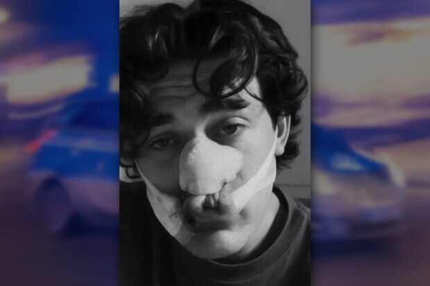 „Wo ist das Gesetz?“ Verletzter US-Tourist nach Messerattacke in Dresden fassungslos