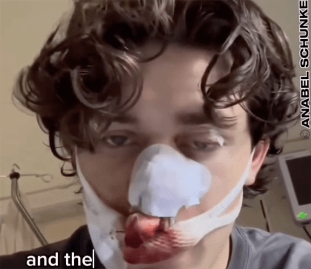 Verzweifelte Bürger hoffen auf Eingreifen der USA, da der BRD-Staat Gewalt gegen Weiße duldet