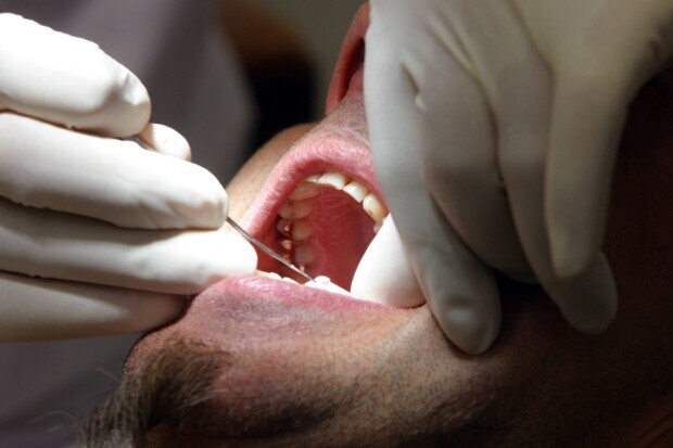 Zuzahlungsfreier Zahnersatz auch für arbeitsunwillige und ausreisepflichtige Flüchtlinge